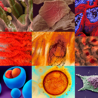 Photoimages of the winning bioimages in the Wellcome Image Awards 2009.