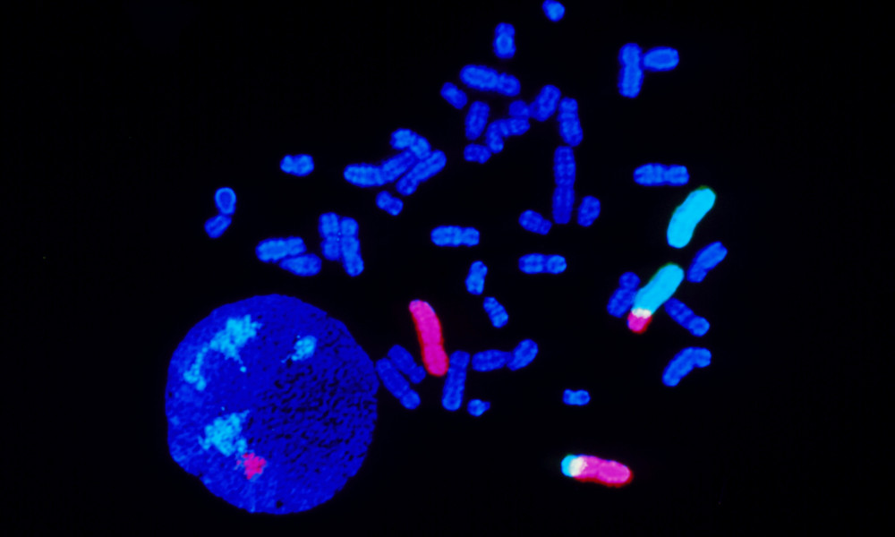 The image shows chromosomes from a cancer patient. Read more in Facts.