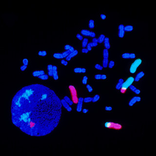 The image shows chromosomes from a cancer patient. Read more in Facts.